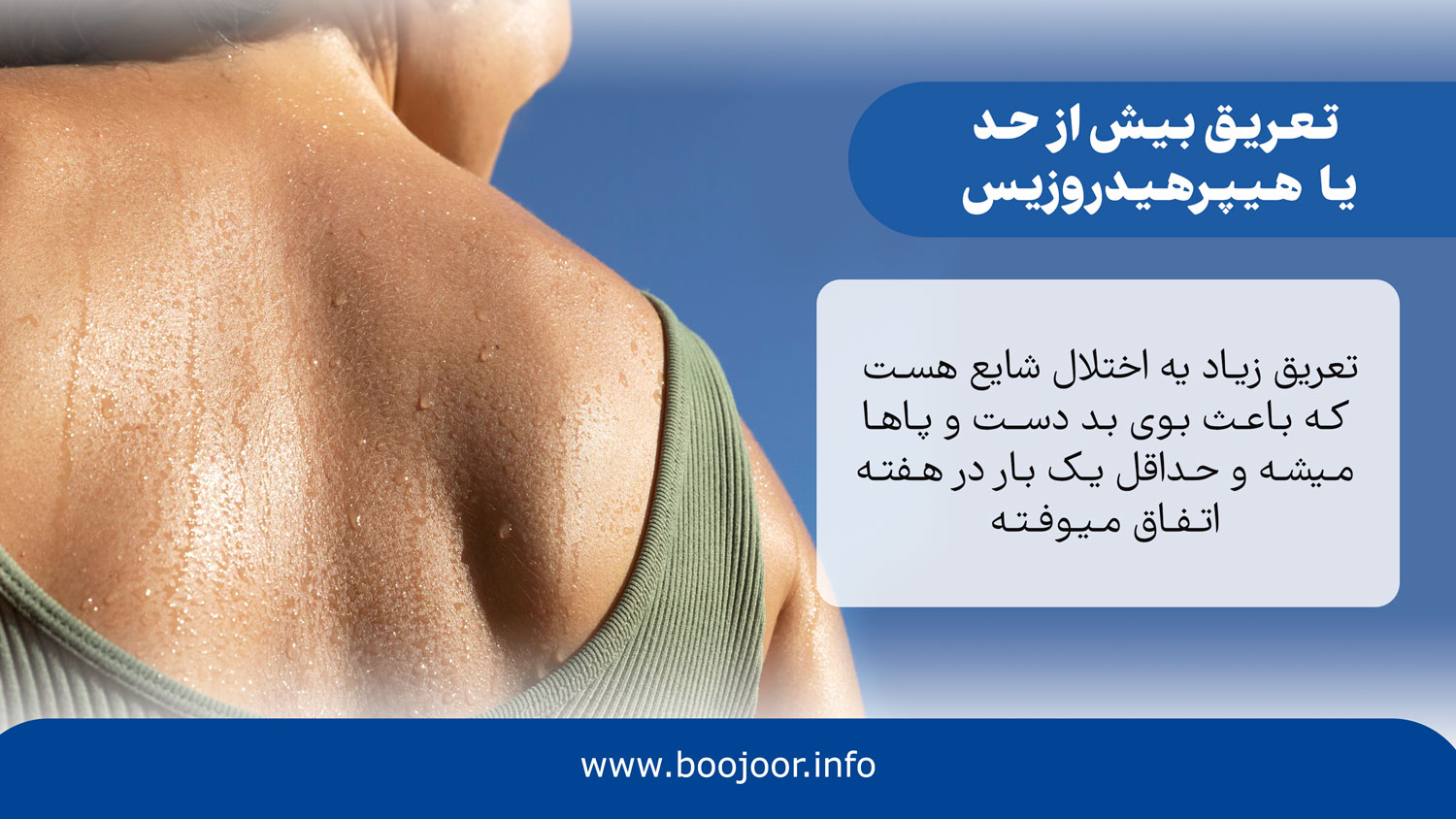 تعریق بیش از حد