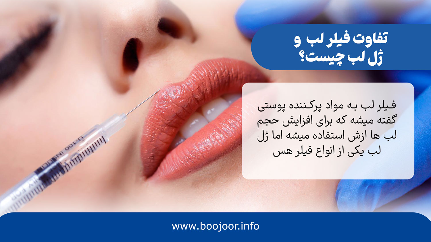 تفاون فیلر لب و ژل لب