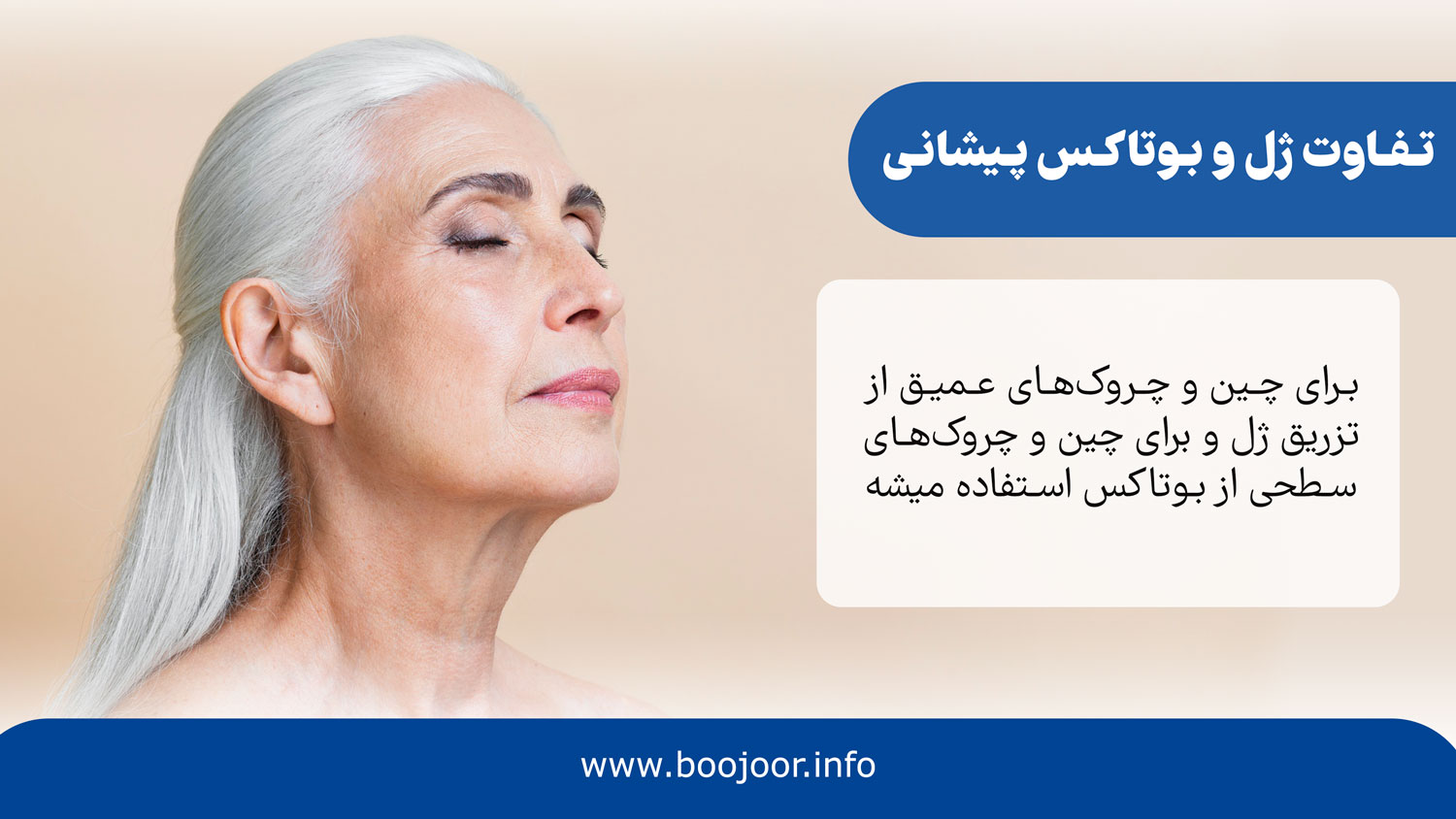 تفاوت بین تزریق ژل و بوتاکس پیشانی