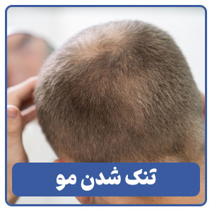 تنک شدن مو