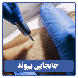 جابجایی پیوند