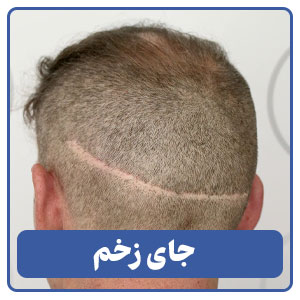 جای زخم قابل مشاهده