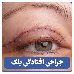 جراحی افتادگی پلک