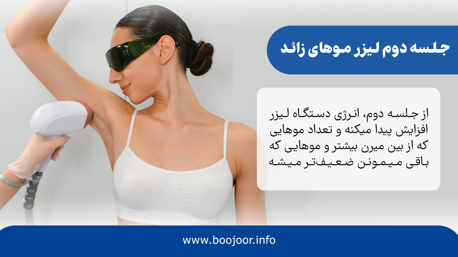 جلسه دوم لیزر موهای زائد