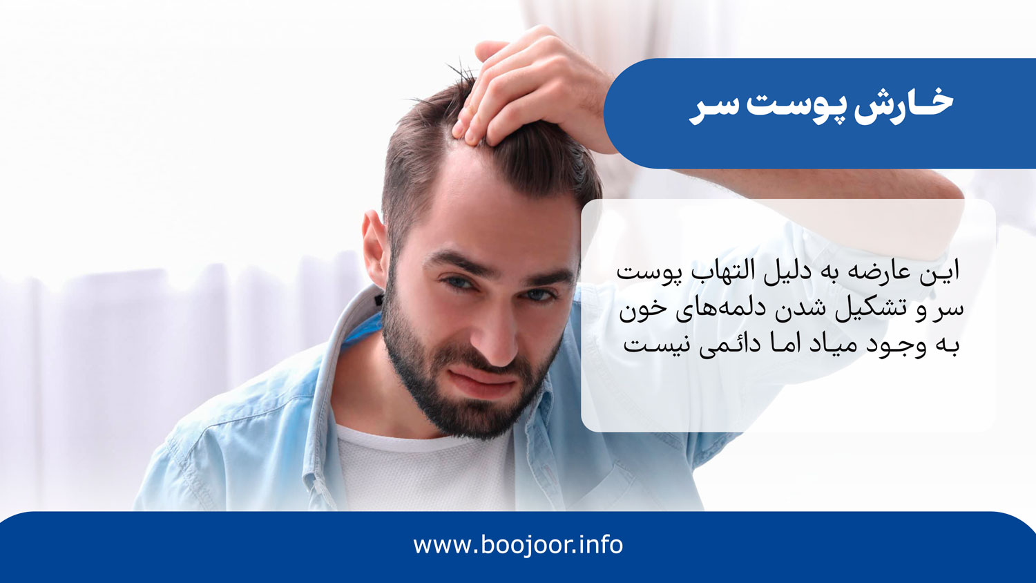 خارش پوست سر