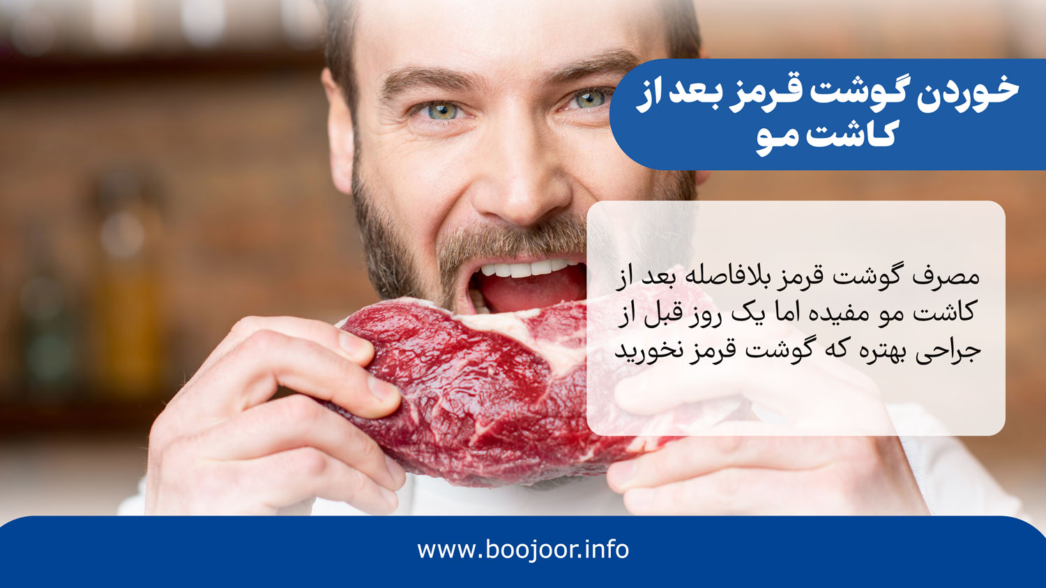 خوردن گوشت قرمز بعد از کاشت مو