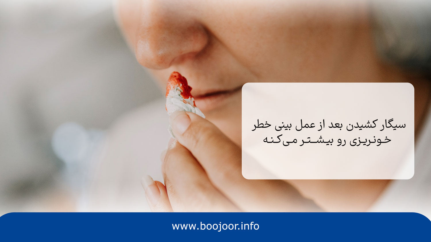 خونریزی بینی یکی از عوارض سیگار کشیدن بعد عمل بینی