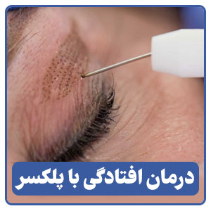 درمان افتادگی پلک با پلکسر