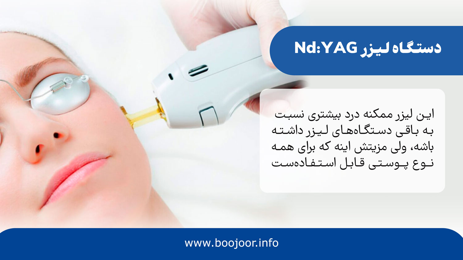 لیزر Nd:YAG