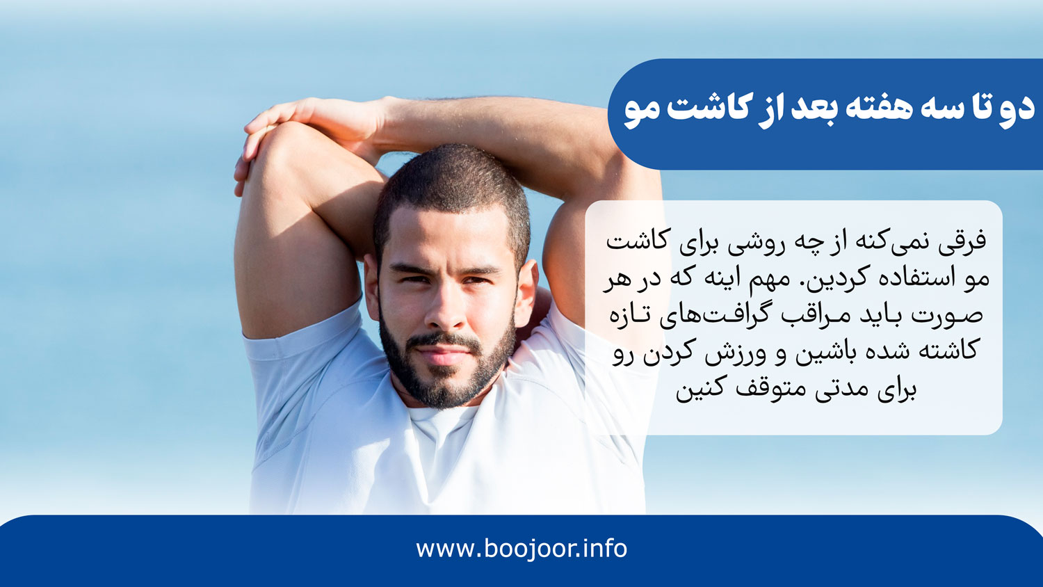 دو تا سه هفته بعد از کاشت مو