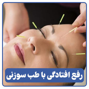 طب سوزنی برای افتادگی پلک