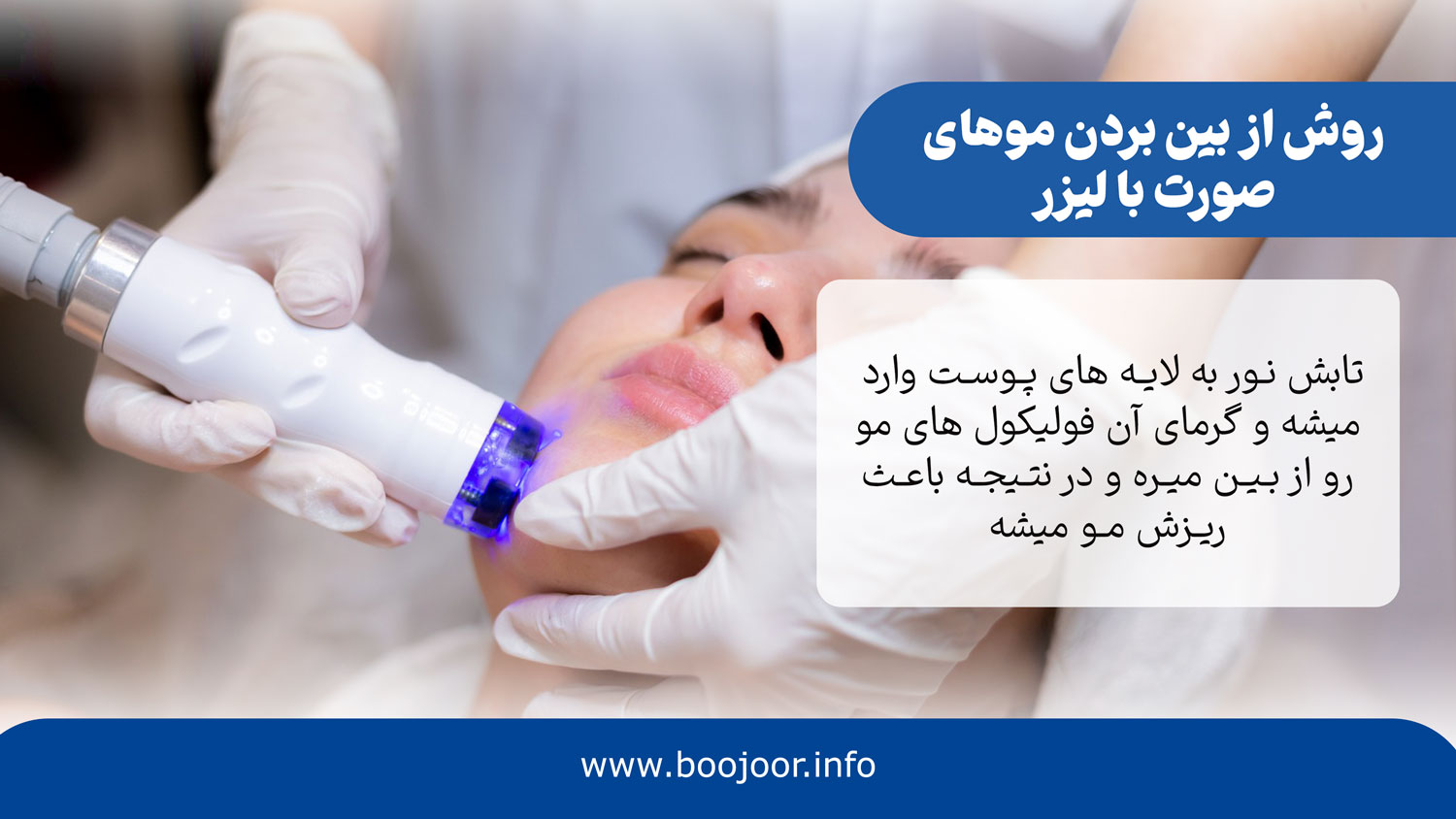 روش از بین بردن موهای صورت با لیزر
