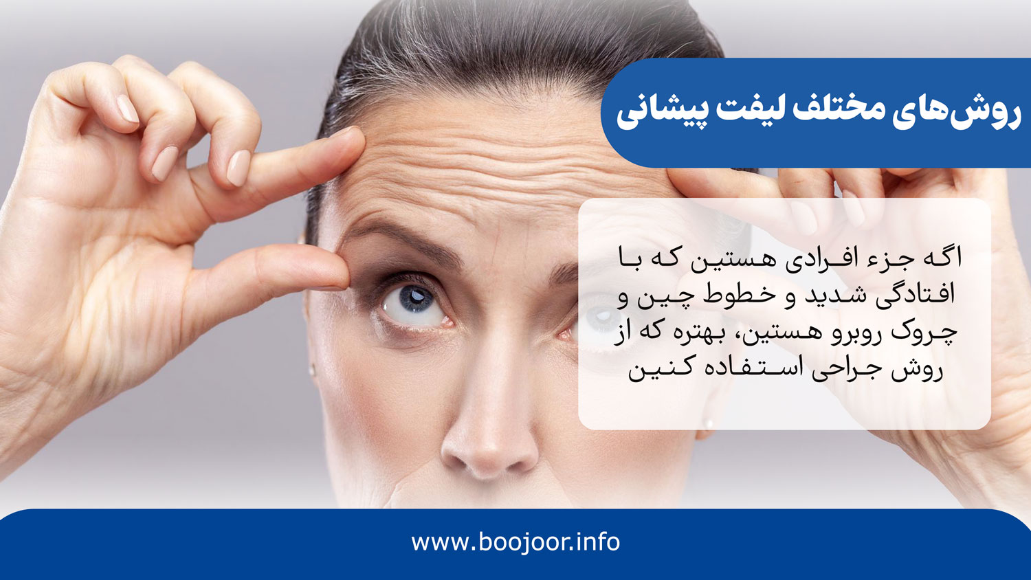 روشهای لیفت پیشانی