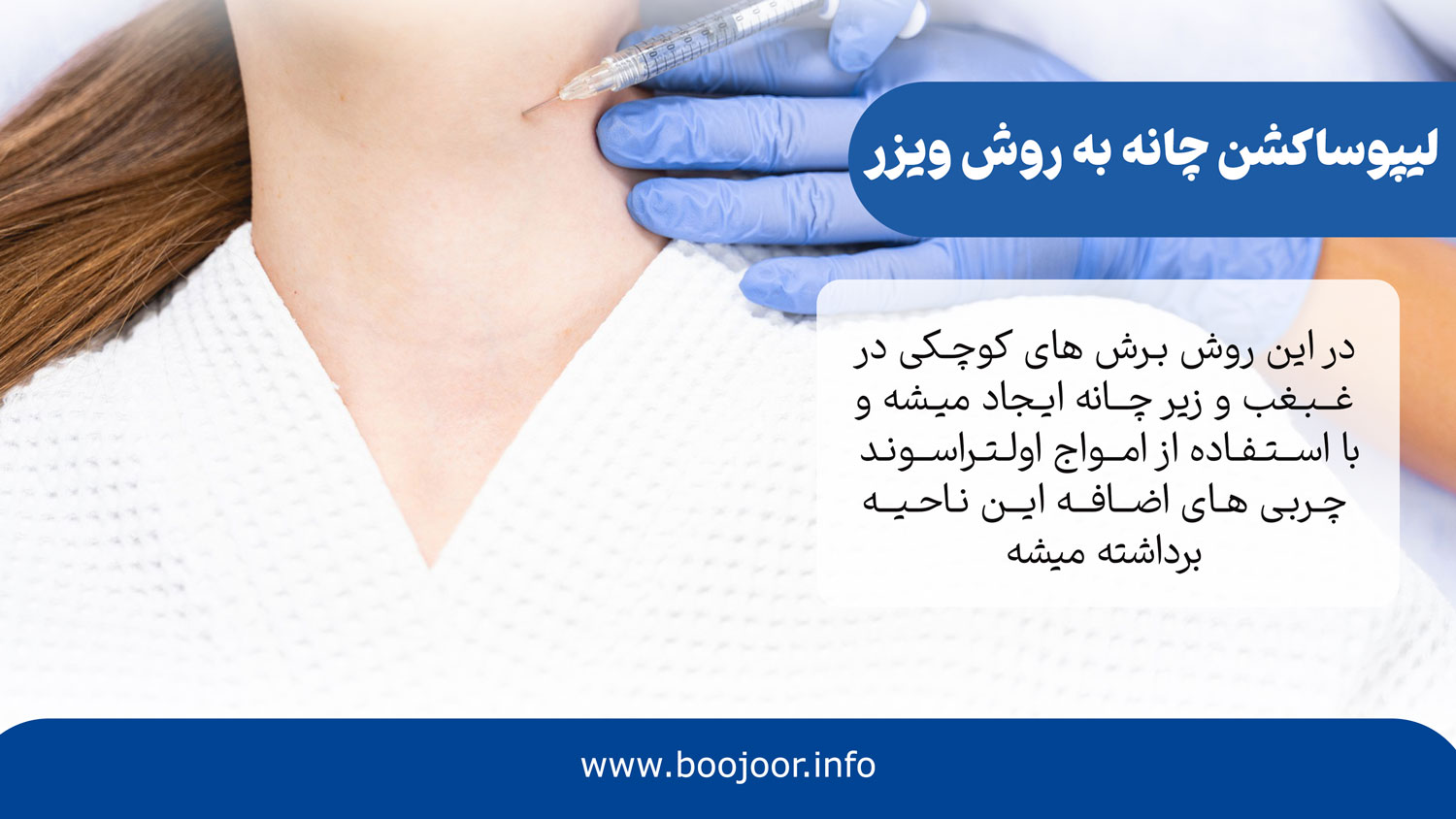 لیپوساکشن چانه با روش ویزر