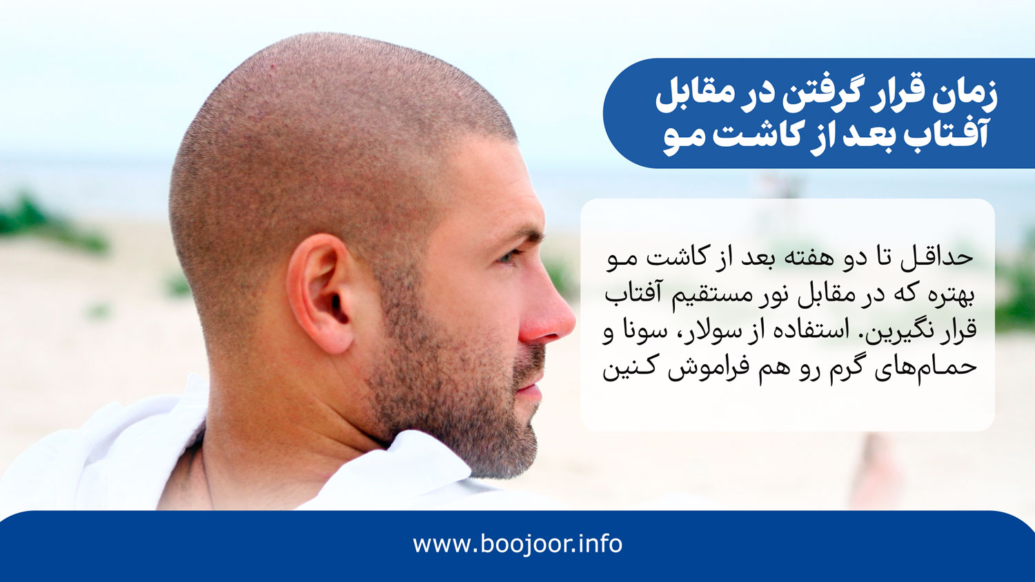 زمان قرار گرفتن در مقابل آفتاب بعد از کاشت مو