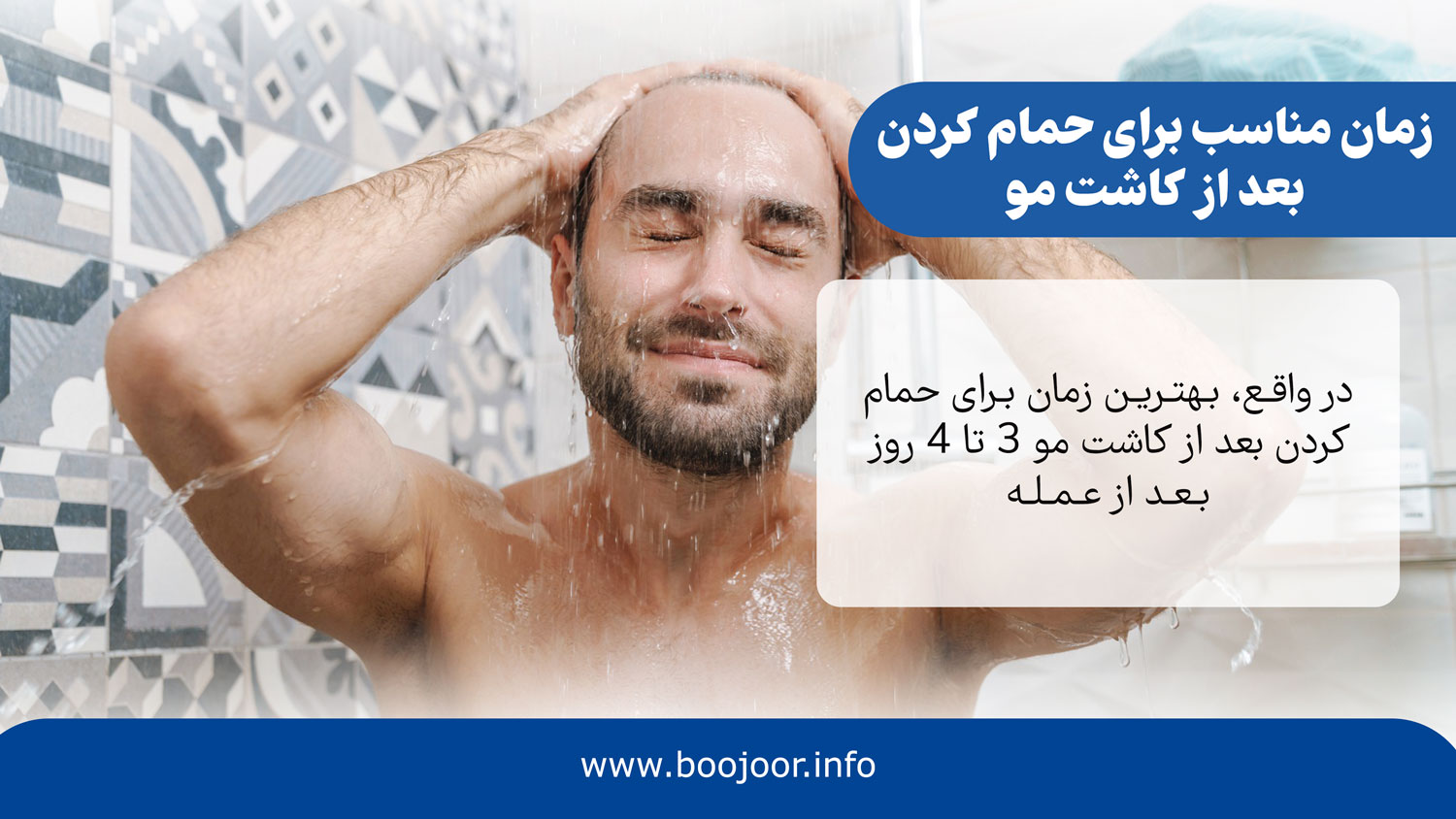 زمان مناسب برای حمام کردن بعد از کاشت مو