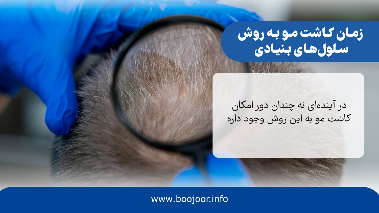 زمان کاشت مو به روش سلول های بنیادی