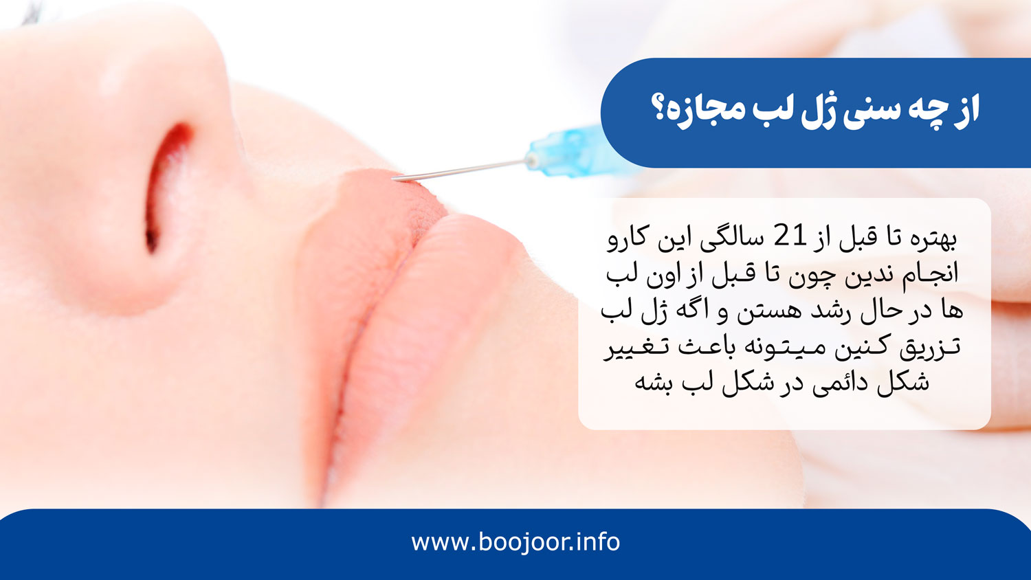 سن مجاز ژل لب