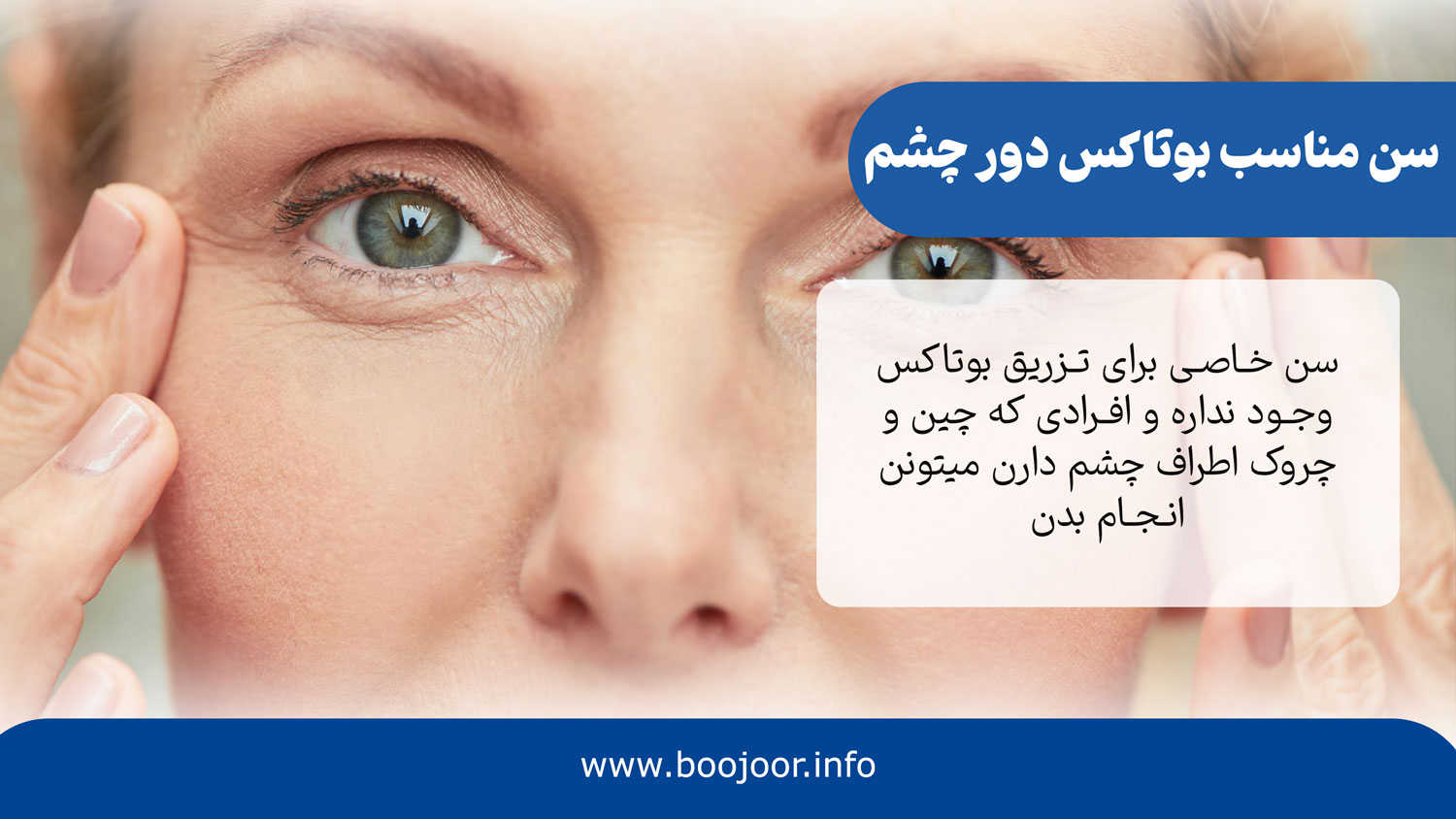 سن مناسب بوتاکس دور چشم