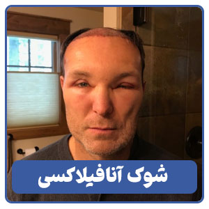 شوک آنافیلاکسی