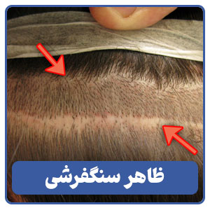 ظاهر سنگفرشی
