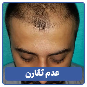 عدم تقارن