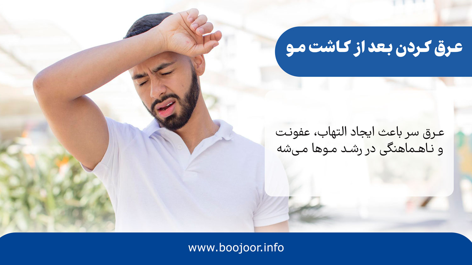 عرق کردن بعد از کاشت مو