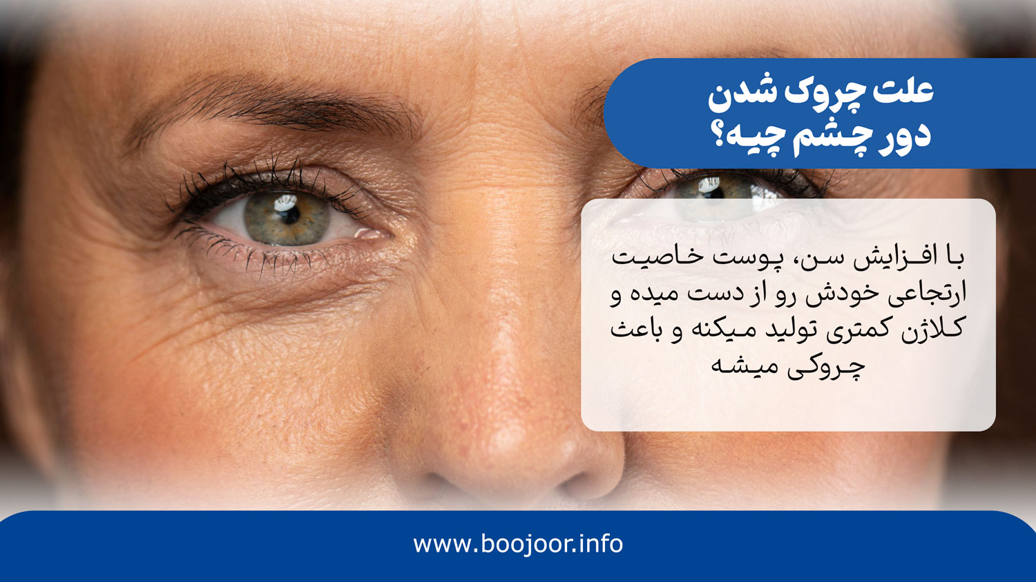 علت چروک شدن دور چشم چیه