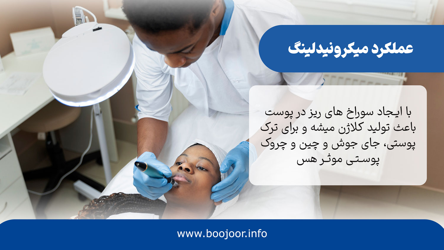 عملکرد میکرونیدلینگ