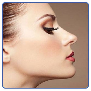  عمل بینی عروسکی دخترانه یکی از انواع عمل بینی عروسکی