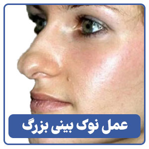 عمل نوک بینی بزرگ توسط بهترین جراح زیبایی در شیراز