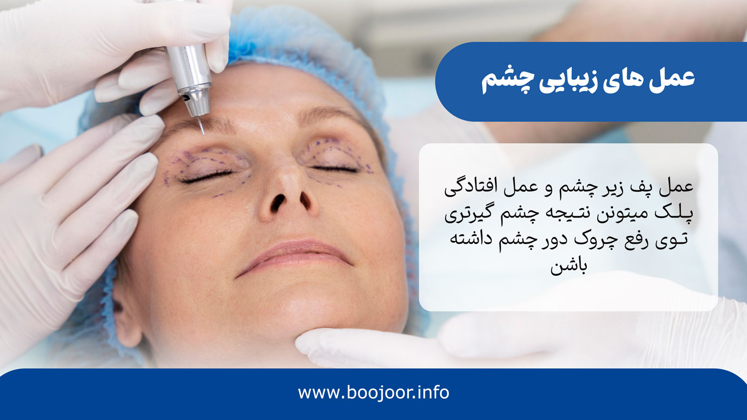 عمل های زیبایی چشم برای کاهش چروک چشم