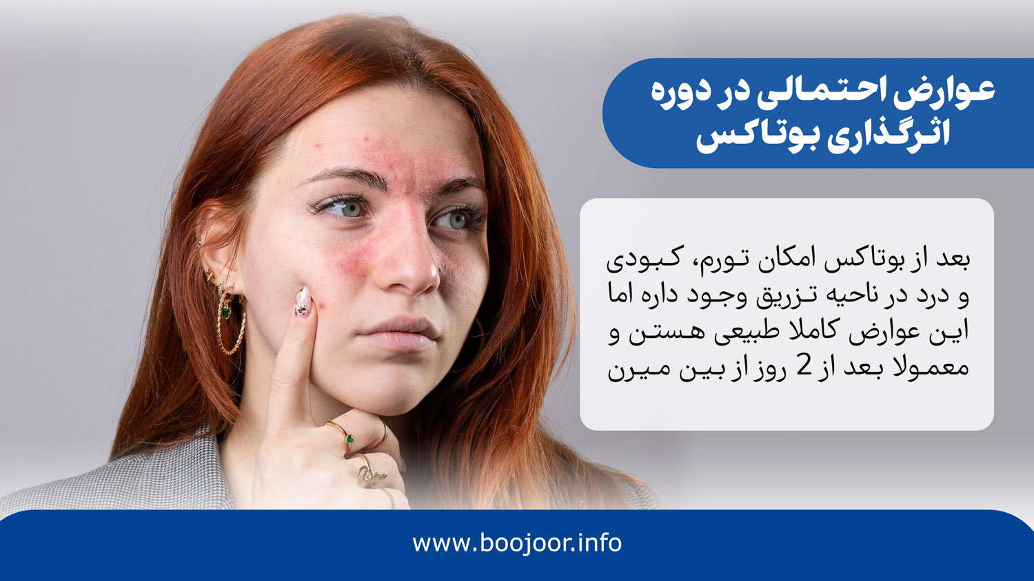 عوارض احتمالی در دوره اثرگذاری بوتاکس