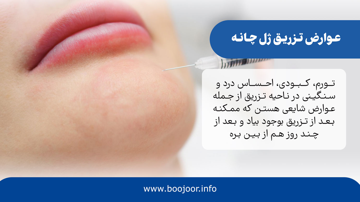 عوارض تزریق ژل چانه
