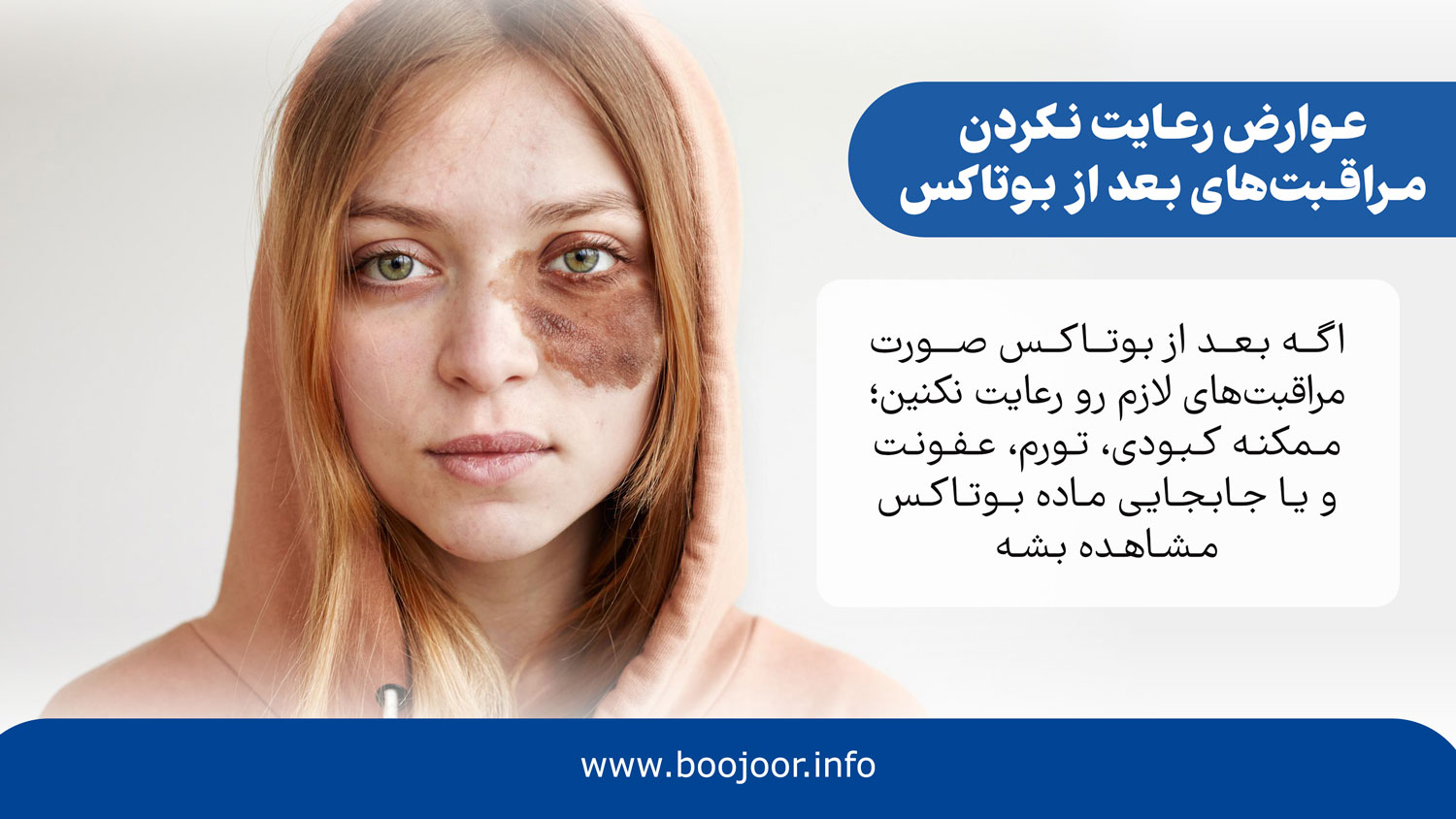 عوارض رعایت نکردن مراقبت های بعد از بوتاکس