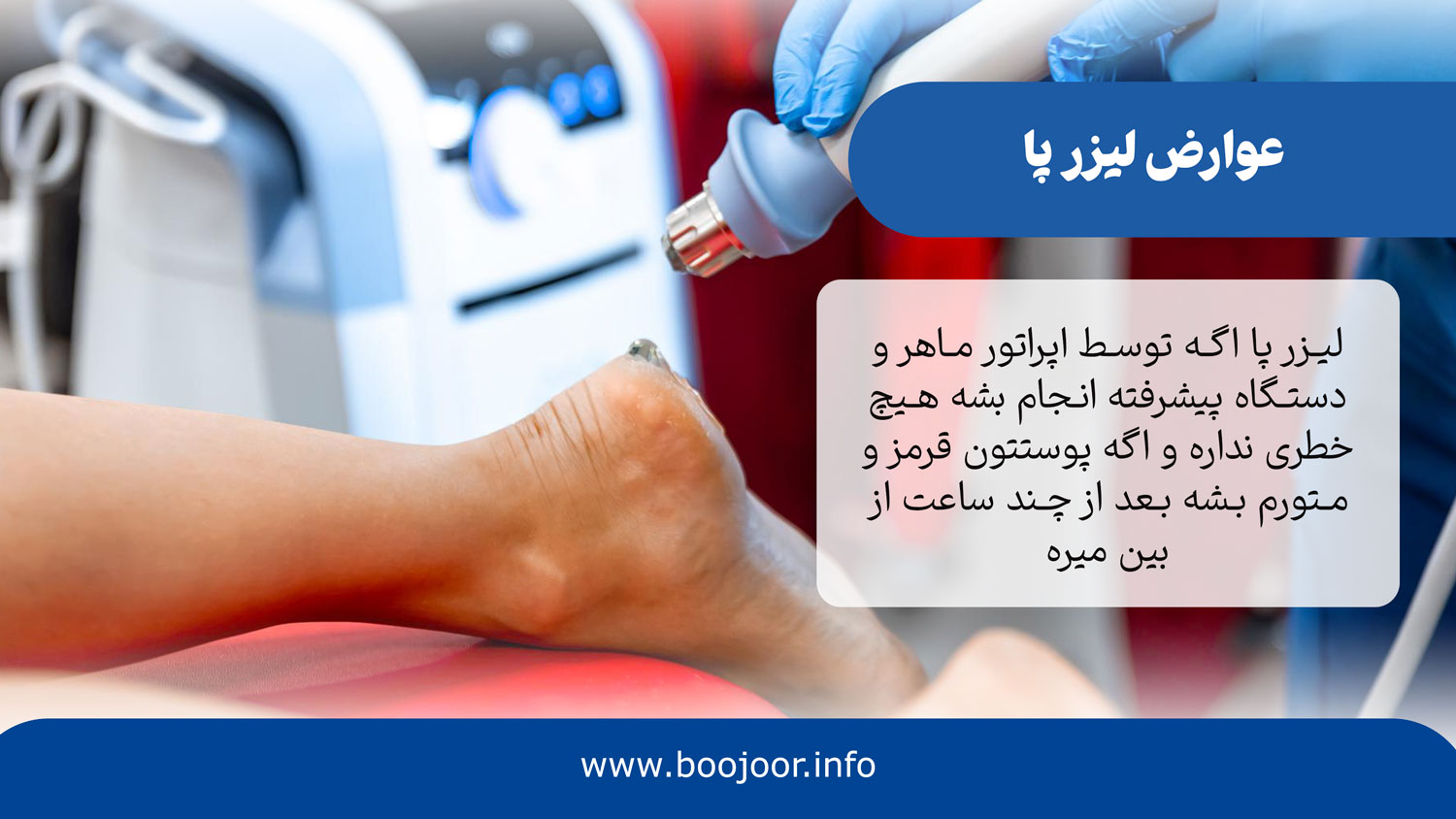 عوارض لیزر پا