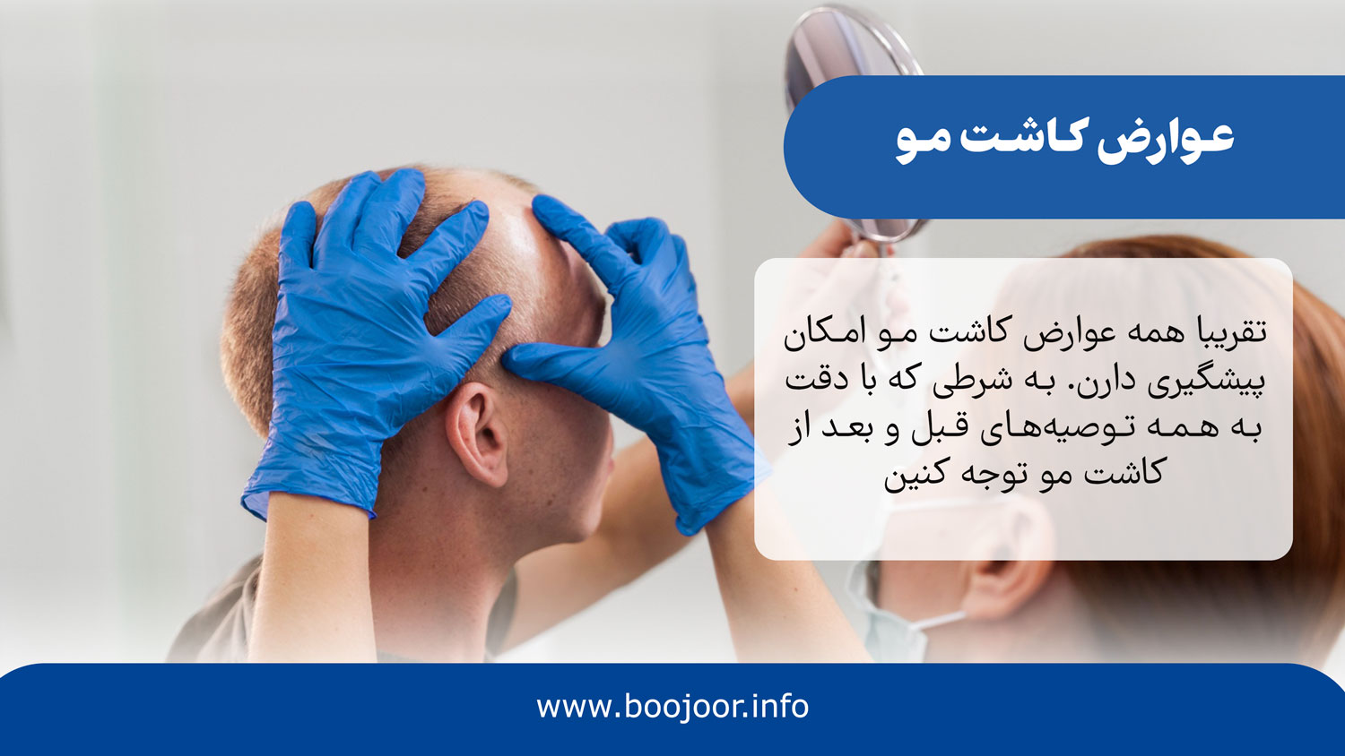 عوارض کاشت مو