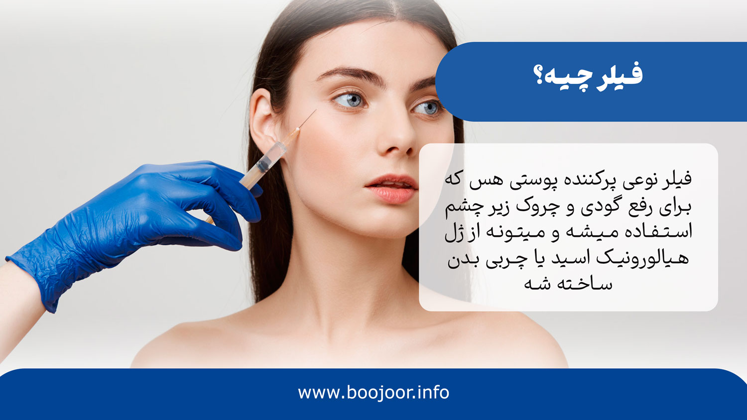 فیلر چیست
