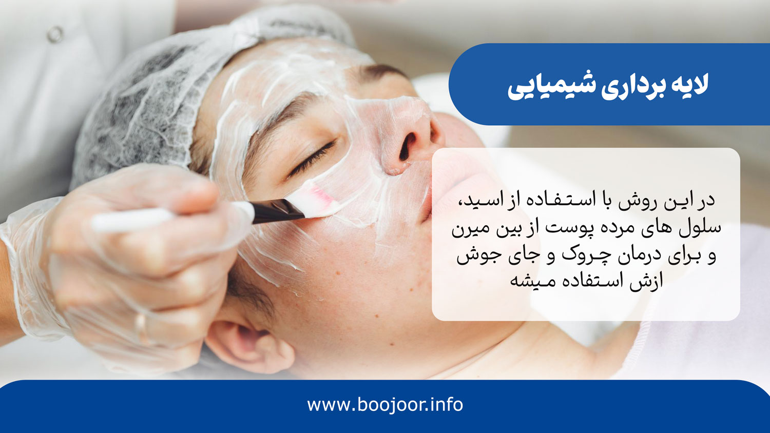 لایه برداری شیمیایی