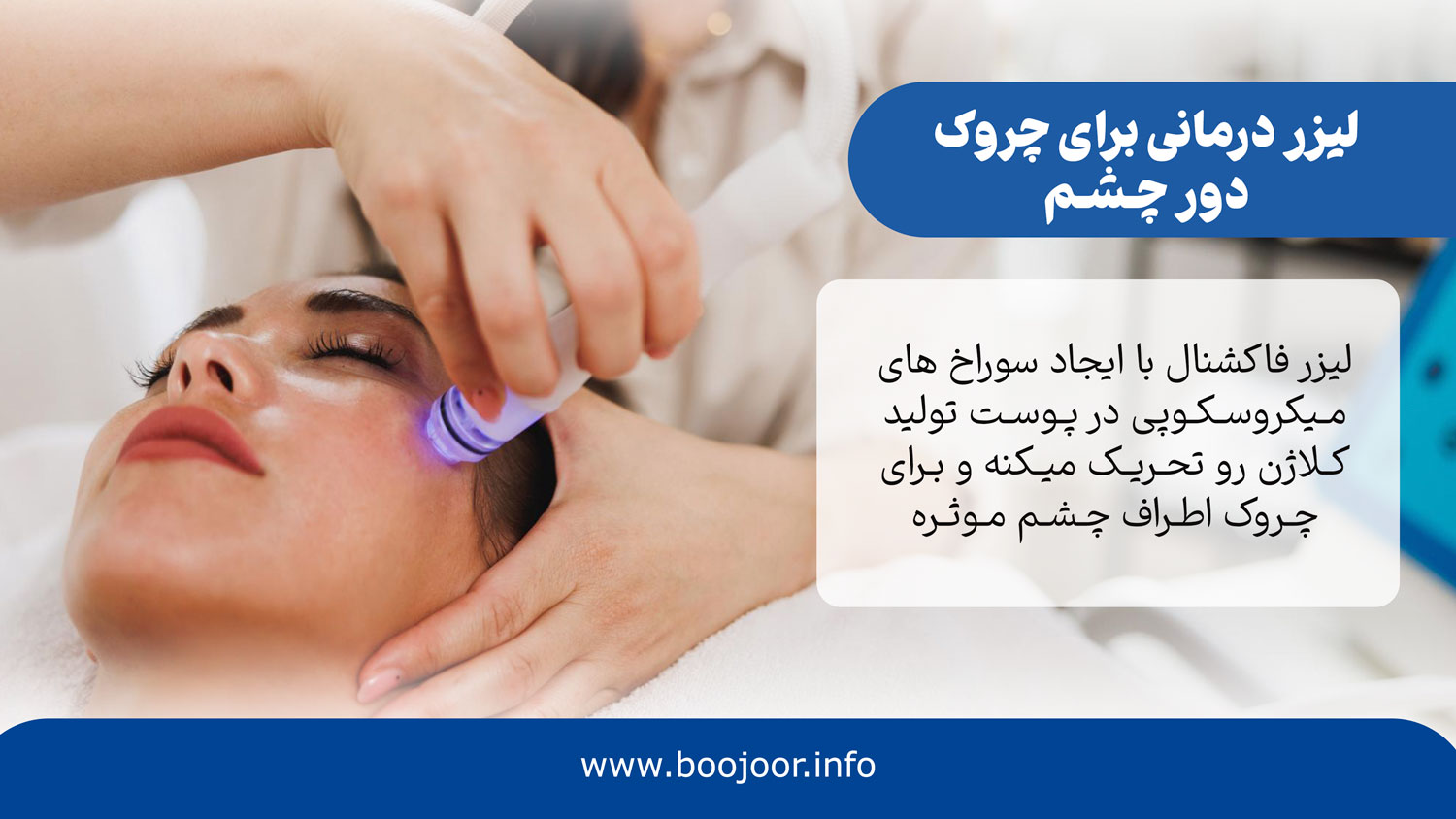 لیزر درمانی برای کاهش چروک چشم