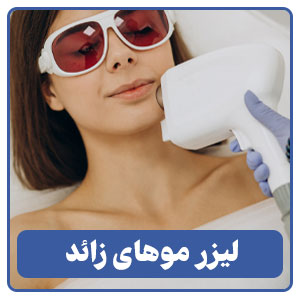 لیزر موهای زائد