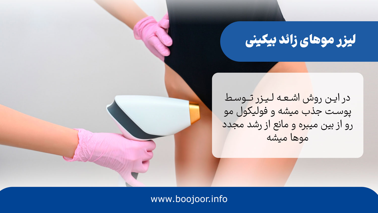 لیزر موهای زائد بیکینی