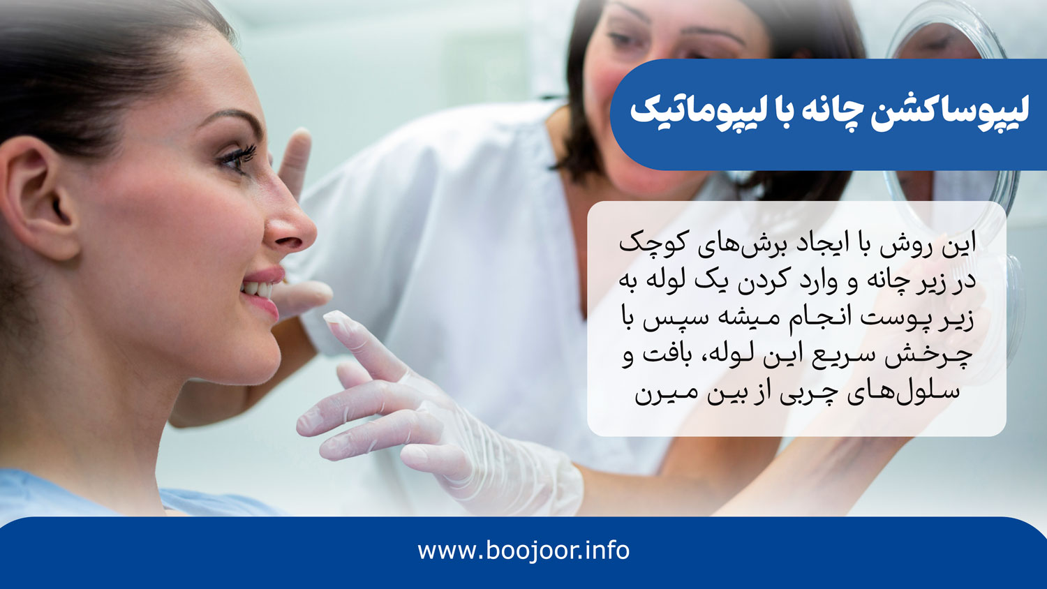 لیپوساکشن چانه به روش لیپوماتیک