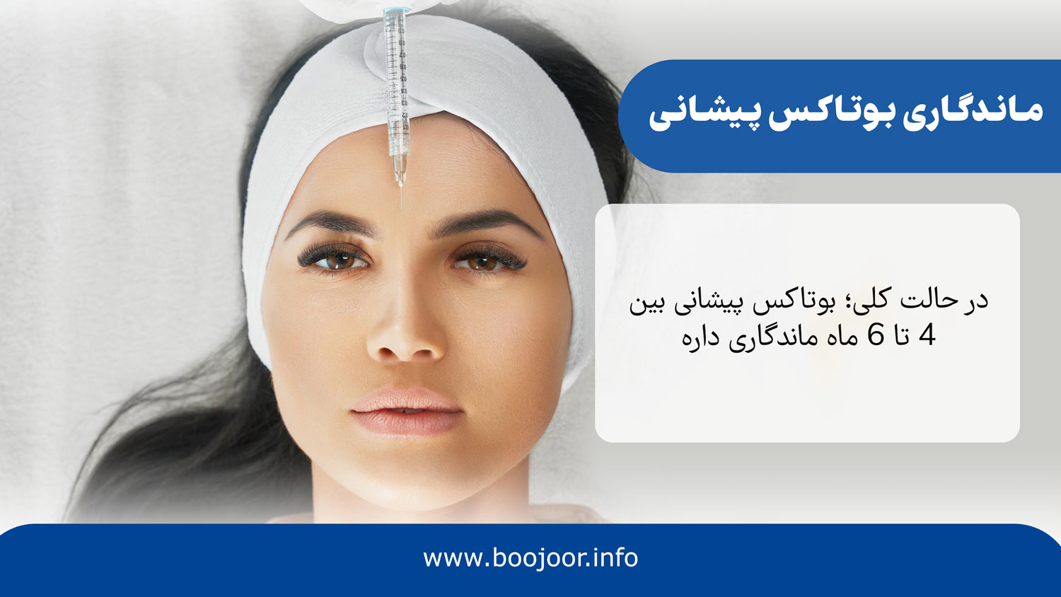 ماندگاری بوتاکس پیشانی