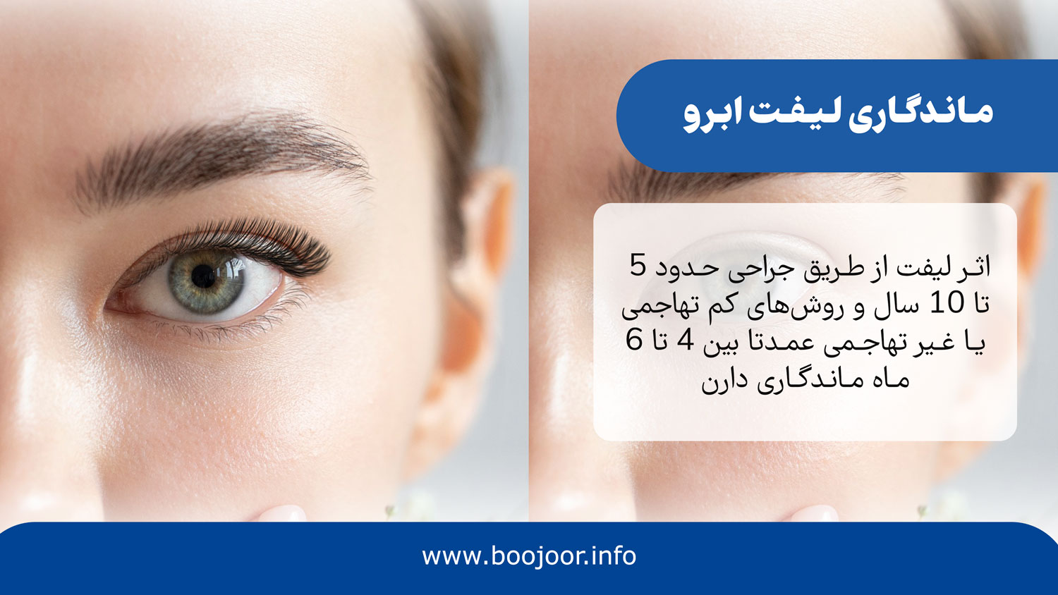 ماندگاری لیفت ابرو