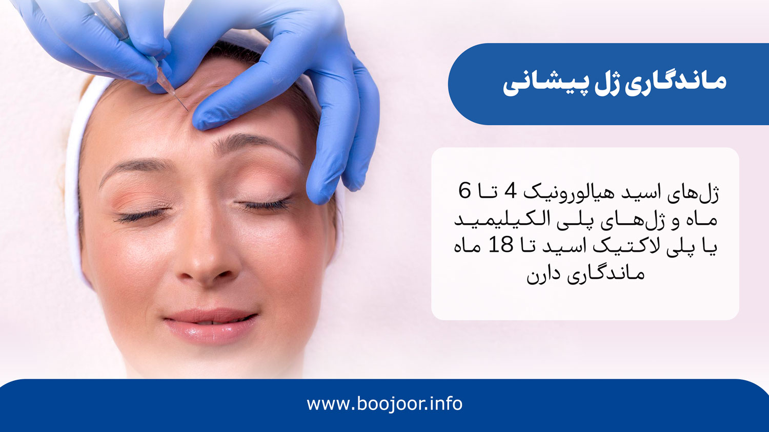 میزان ماندگاری ژل پیشانی