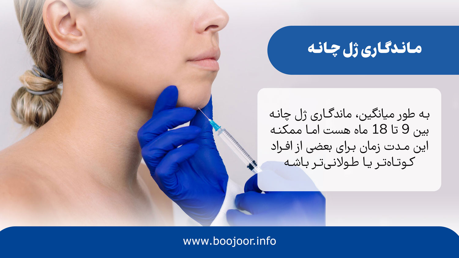 ماندگاری ژل چانه