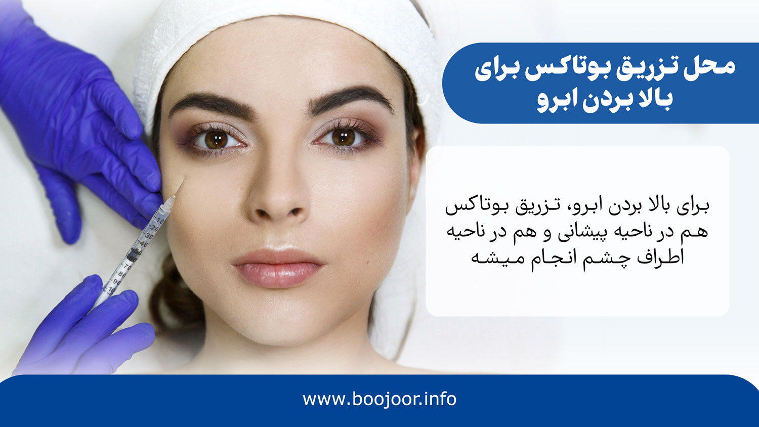 محل تزریق بوتاکس برای بالا بردن ابرو