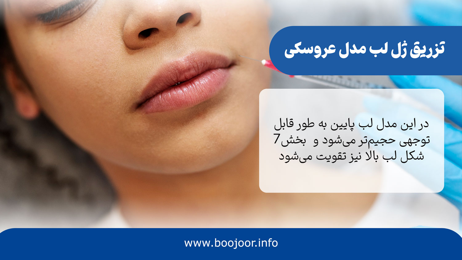 ژ ل لب مدل عروسکی