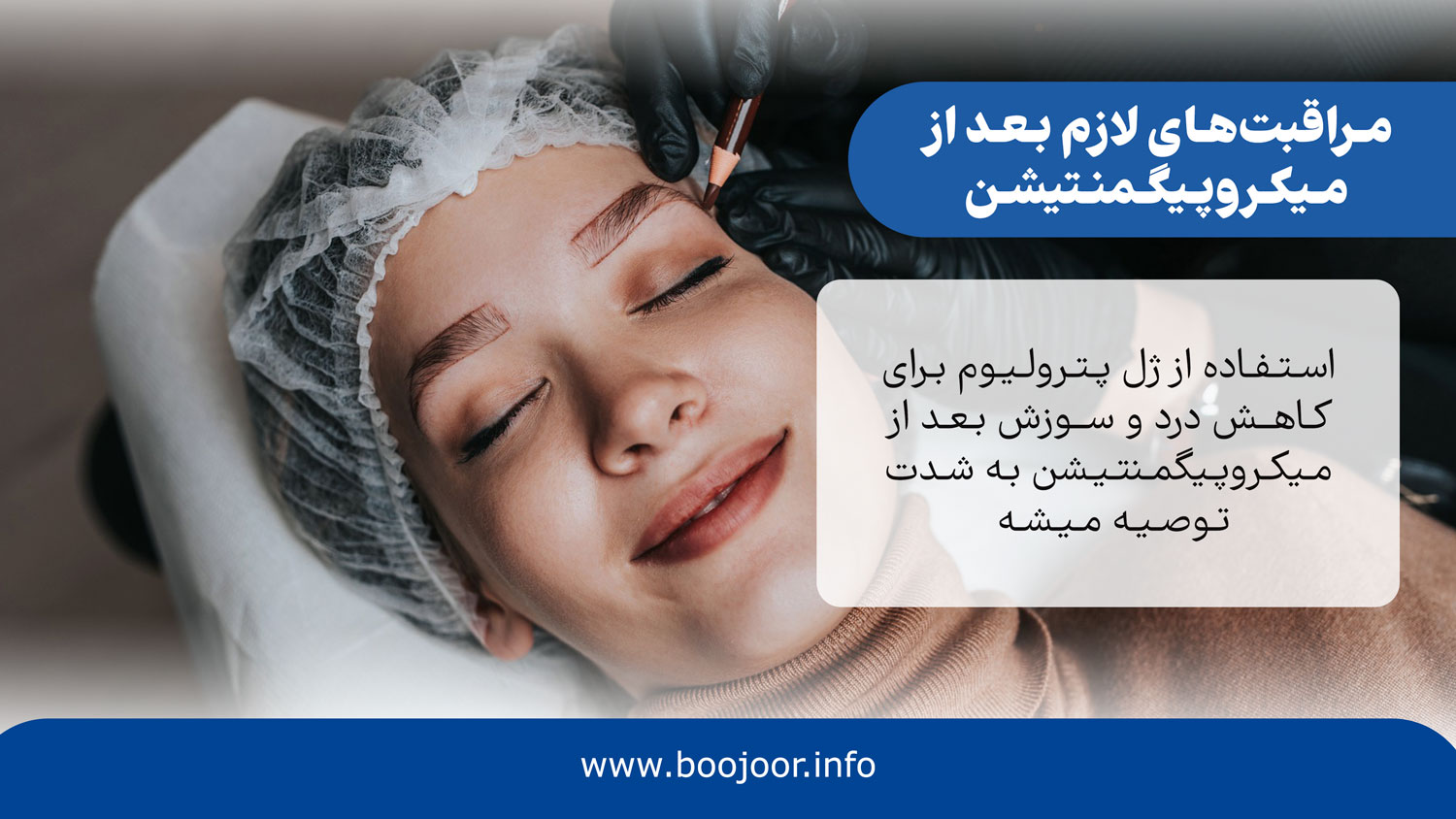 مراقبت های لازم بعد از میکروپیگمنتیشن